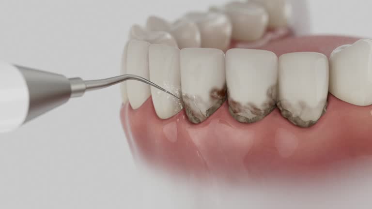 Reliable Dental contractor in Laguna Woods, CA by Dentist Open Now